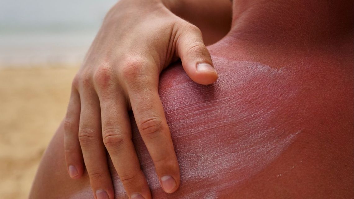 Índice UV bajo en Argentina: un respiro invernal para la salud