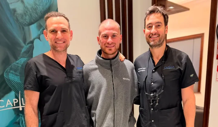 Alexis Mac Allister se realizó un implante capilar en Buenos Aires tras el Mundial 2026