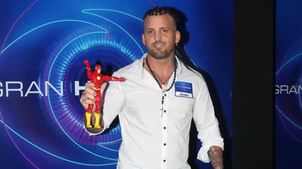 Juan Reverdito dejó las trenzas y mostró su cambio de look tras un implante capilar