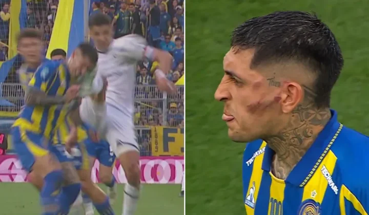 Preocupación en Rosario Central: la patada que recibió Gastón Ávila y el parte médico que encendió las alarmas