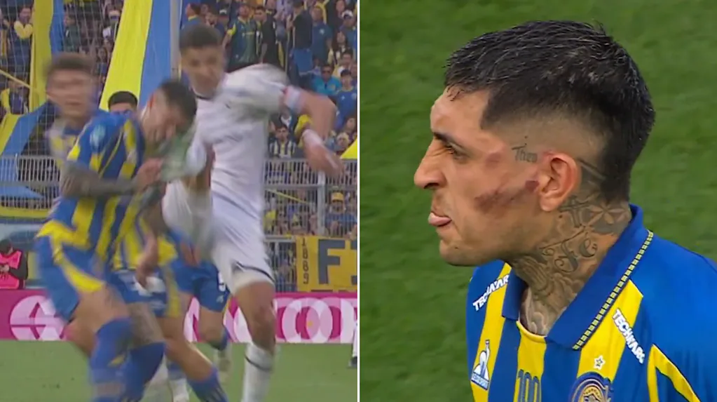 Preocupación en Rosario Central: la patada que recibió Gastón Ávila y el parte médico que encendió las alarmas